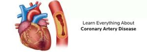 Coronary artery diseases