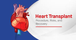 What is Heart transplantation