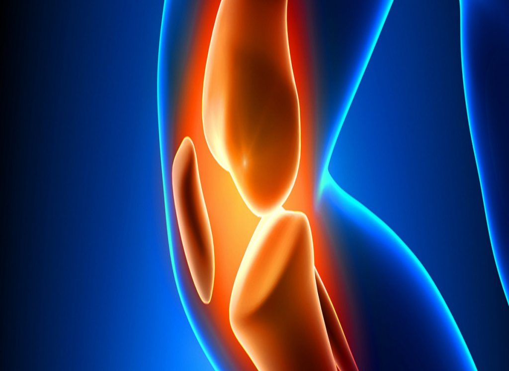 What are the risks of total knee replacement?