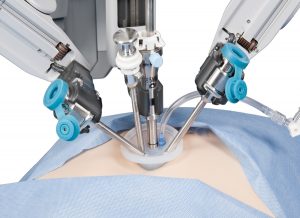  Robotic Laparoscopy Procedure