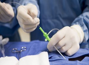  Operational Procedure During Minimal Invasive Surgery