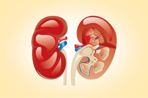 kidney-transplant